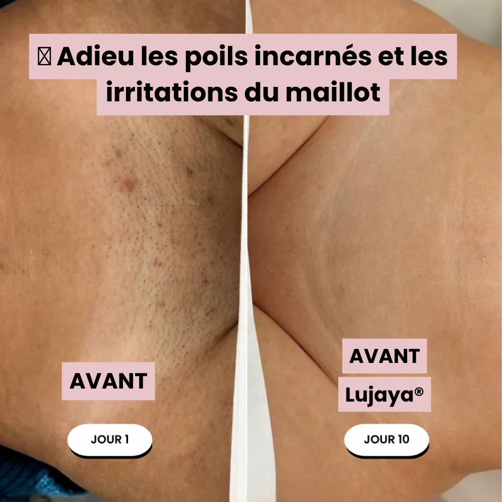 Lujaya® Rasoir Électrique 5 en 1 pour Femme