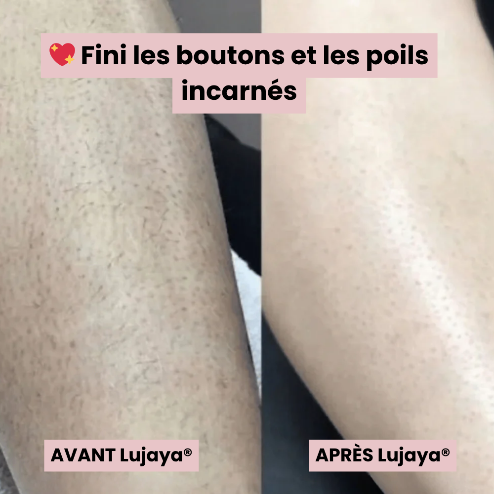 Lujaya® Rasoir Électrique 5 en 1 pour Femme