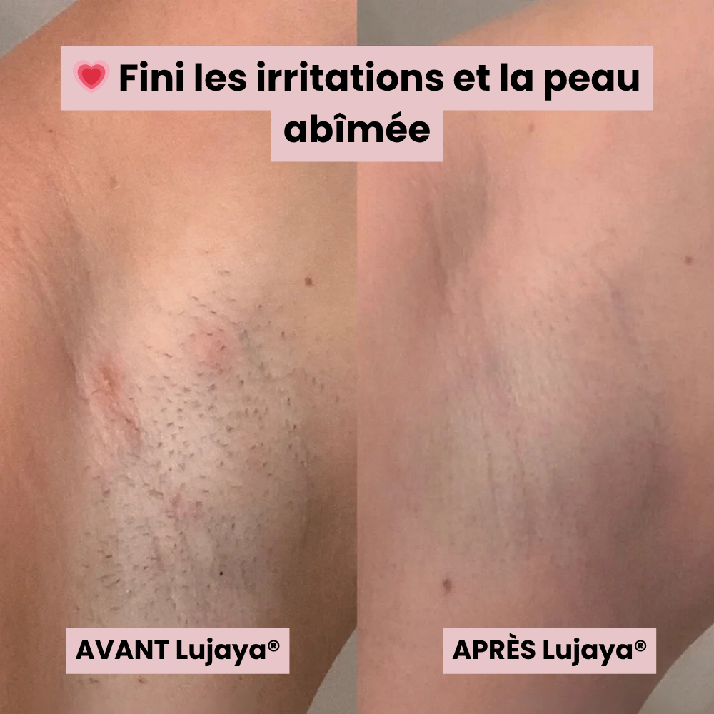 Lujaya® Rasoir Électrique 5 en 1 pour Femme