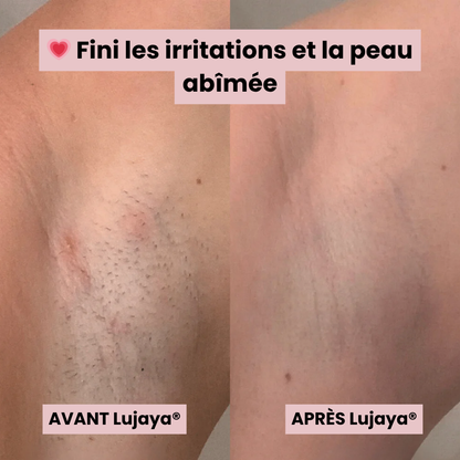 Lujaya® Rasoir Électrique 5 en 1 pour Femme